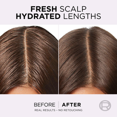 L'Oréal Paris Elvive Hyaluron Pure Serum - 102ml