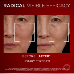 L’Oréal Paris Revitalift Triple Power Age-Correcting Serum - 30ml