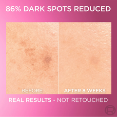 L’Oréal Paris Glycolic Bright Face Serum - 30ml